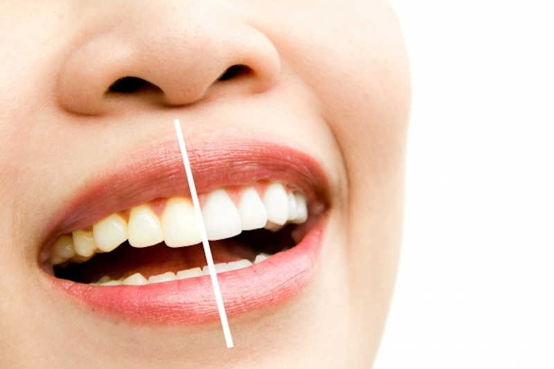Dental Treatment